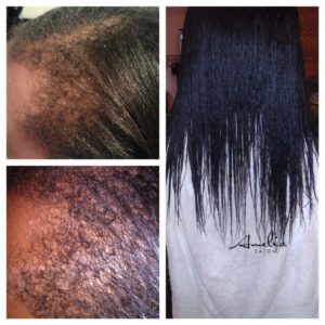 AmeliaSalon.com-Postpartum-Alopecia